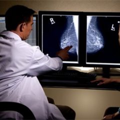 Pruebas de imagen, soluciones ya!